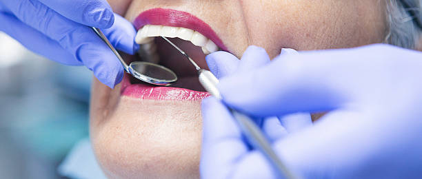 Best Dentist for Tooth Abscess  in Mora, MN